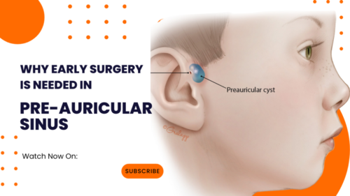 preauricular sinus